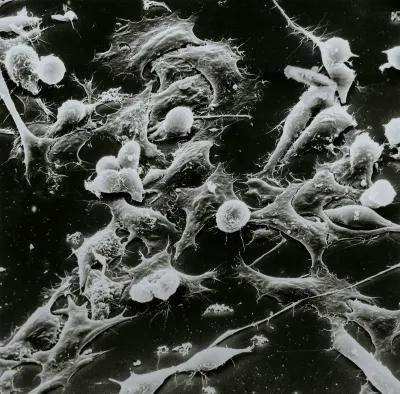 NCI Cancer Cells