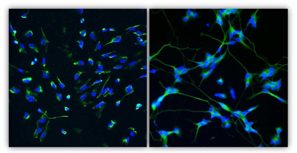 Ageing in the Human Brain: A Focus on Neuroprotection and Healthy Ageing